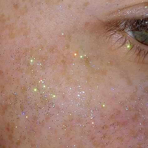 Star Freckles Aesthetic, Freckle Constellation, Freckle Aesthetic, Glowing Freckles, Constellation Freckles, Constellations Aesthetic, Constellation Aesthetic, Gold Freckles, Star Freckles