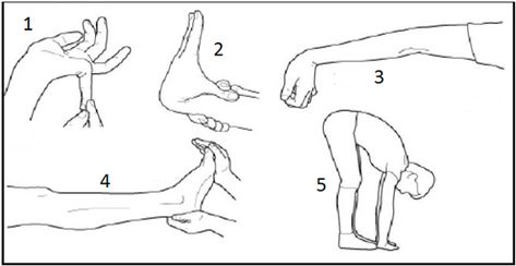 Beighton score - Physiopedia Osteogenesis Imperfecta, Static Stretching, Mast Cell Activation Syndrome, Chiari Malformation, Double Jointed, Yoga Anatomy, Spoonie Life, Connective Tissue, Ehlers Danlos