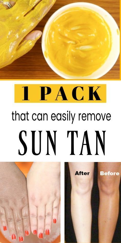 #SuntanRemoval #SuntanRemovalTips Suntan removal remedies how to remove sun tan from hands how to remove tan from face for womens sun tan removal cream how to remove tan from face for mens how to remove tan from feet how to remove old tan from face how to remove tan from neck how to remove tan from forehead Tan Removal Remedies, Tan Removal Home Remedies, Remove Tan From Face, Tan Removal Face Pack, Skin Tan Removal, Sun Tan Removal, Natural Bleach, Skin Face Mask, Sun Burn