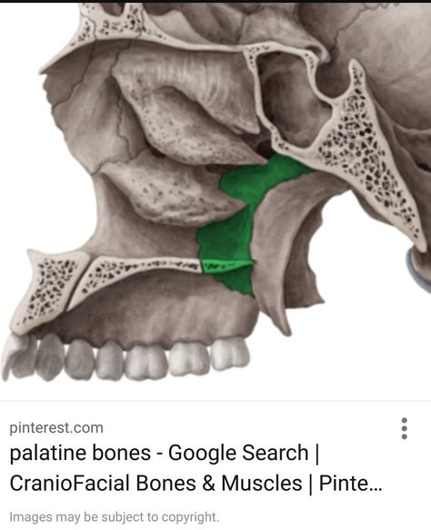 Palatine Bone, Biology Diagrams, Head Anatomy, Radiology Tech, Bones And Muscles, Radiology, Head And Neck, Aesthetic Stickers, Human Body