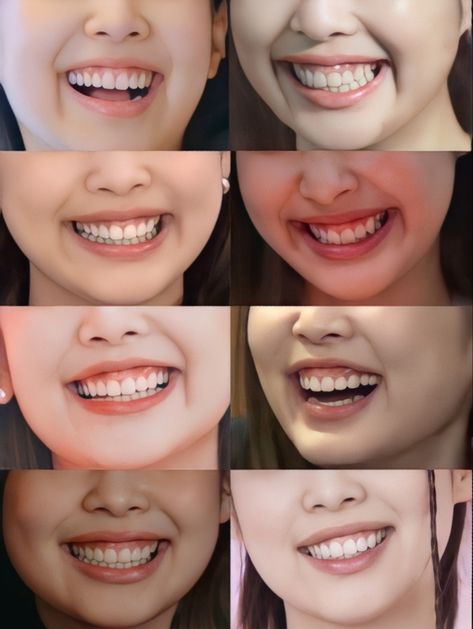 Lisa Gummy Smile, Jennie Gummy Smile, Easy Photography Ideas, Gummy Smile, Clear Healthy Skin, Perfect Teeth, Smile Lines, Smile Teeth, Black Hair Kpop