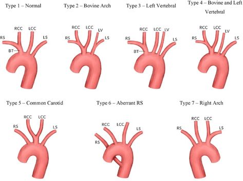 Idr Labs Test, Vertebral Artery