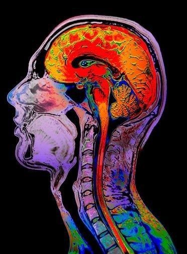 Brain Mri Scan, Brain Mri, Drawing The Human Head, Systems Art, Mri Scan, Brain Art, Magnetic Resonance Imaging, Bio Art, Human Anatomy Art