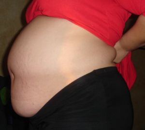 The B Belly is very common for plus size women during pregnancy but no one talks about it. Until now... Bump Progression, Obese Pregnancy, 11 Weeks Pregnant, 22 Weeks Pregnant, 16 Weeks Pregnant, Natural Childbirth, 20 Weeks Pregnant, Pregnancy Bump, Belly Bump