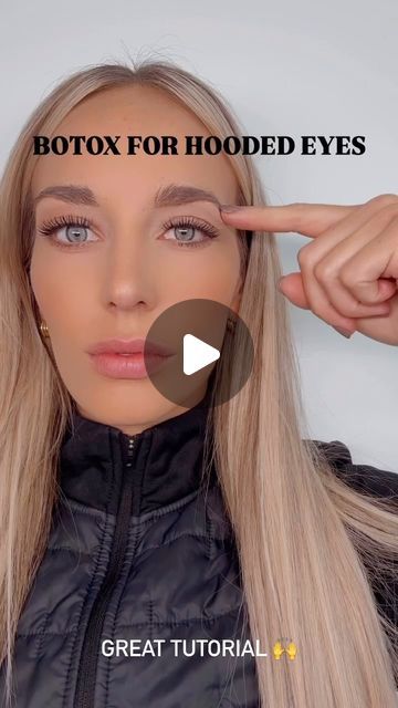 Modern Beauty Con on Instagram: "Love this tutorial for Botox with hooded eyes 💉

RP: @nurse.kas.glass 

Join MBClub to get direct access to experts  the latest scientific discoveries, beauty trends and products. Ask questions. Get quality answers. Guaranteed.

#medspa #medspas #medspalife #aesthetic #aesthetics #aestheticbeauty #injections #filler #fillers #botox #tox #acne #skin #facial #facials #injector #medspaconference #aestheticconference #injectorlife #cosmeticinjector #aestheticinjector #injectormemes #nurseinjector #medspamarketing #marketing #botoxinjections" Forehead Botox Before And After, Natural Botox For Face, Botox Injection Sites Diagram, Facial Fillers Before And After, Botox Under Eyes Before And After, Botox For Hooded Eyelids, Botox Brow Lift Before And After, Before And After Botox Pictures, Botox Before After