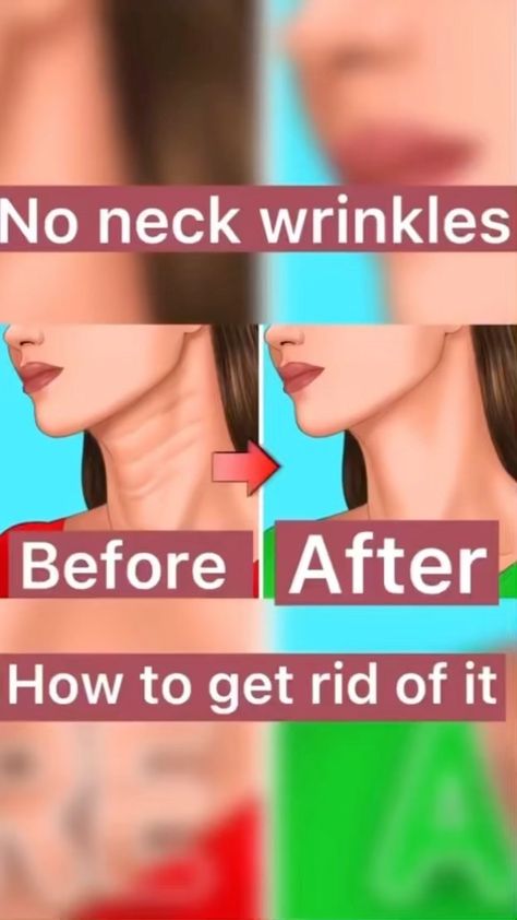 beauty.remedys on Instagram: Follow @weightlossend How to get rid of neck wrinkles Are you ready to do this? 🎉Get a Free Weight Loss Powder at the link in our bio💟 🙋… Exercise List, Facial Exercise, Double Chin Exercises, Chin Exercises, Yoga Facts, Instagram Face, Simple Exercise, Makeup Tip, Neck Exercises