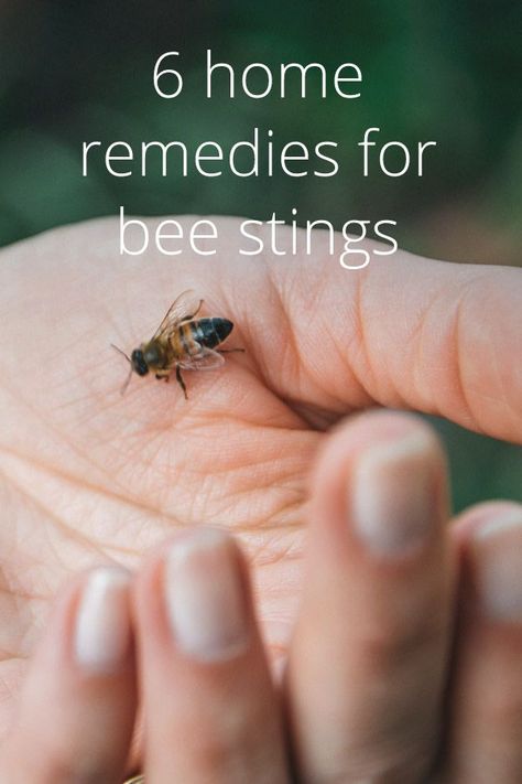 In case you ever run into a situation where a bee stings you ... some natural remedies to deal with the pain!  #naturalremedy #naturalhealing #beesting #beestingremedy #beekeeping #beeremoval #beekeeper #beecontrol Wasp Sting Remedy, Remedies For Bee Stings, Natural Remedies For Congestion, Sting Relief, Wasp Stings, Natural Remedies For Allergies, Headache Prevention, Allergy Remedies, Chest Congestion