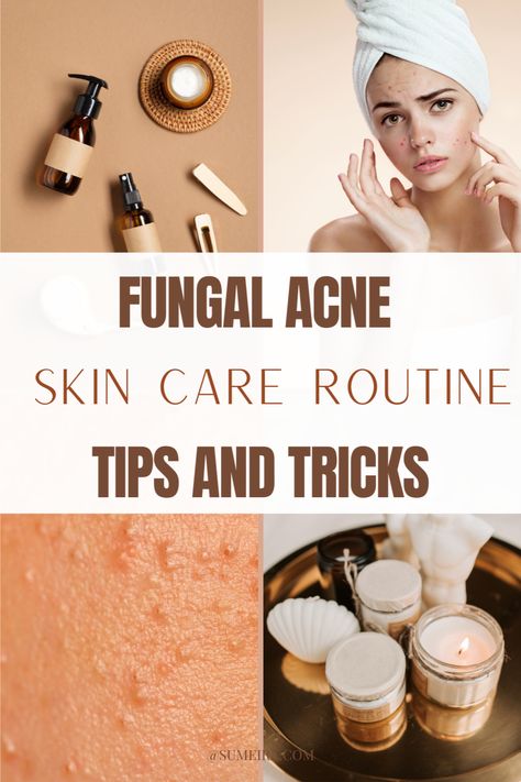 Explore practical strategies for treating and preventing fungal acne with our guide. Dive into the world of fungal acne skincare routine, fungal acne safe products, and effective treatments. Transform your skincare routine and bid farewell to fungal acne for good. Website to check fungal acne safe ingredients included! Nizoral For Fungal Acne, Skincare For Fungal Acne, Fungal Acne Safe Products, Fungal Acne Skin Care Routine, What Is Fungal Acne, Acne Ingredients, What Causes Fungal Acne, Treat Fungal Acne, Comedonal Acne