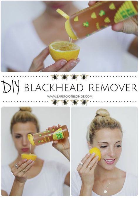 2 Ingredient Black Head Remover – Bath and Body Blackhead Remover Diy, Rid Of Blackheads, Barefoot Blonde, Diy Kosmetik, Get Rid Of Blackheads, Beauty Remedies, Honey Lemon, Homemade Remedies, Beauty Recipe