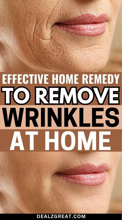 8 Natural Home Remedies To Get Rid Wrinkles - DealzGreat | Beauty lovers who want to share their passion. Rid Wrinkles, Natural Wrinkle Remedies, Wrinkles Remedies Face, Home Remedies For Wrinkles, Get Rid Of Wrinkles, Wrinkle Remedies, Underarm Hair Removal, Under Eye Wrinkles, How To Get Rid Of Pimples