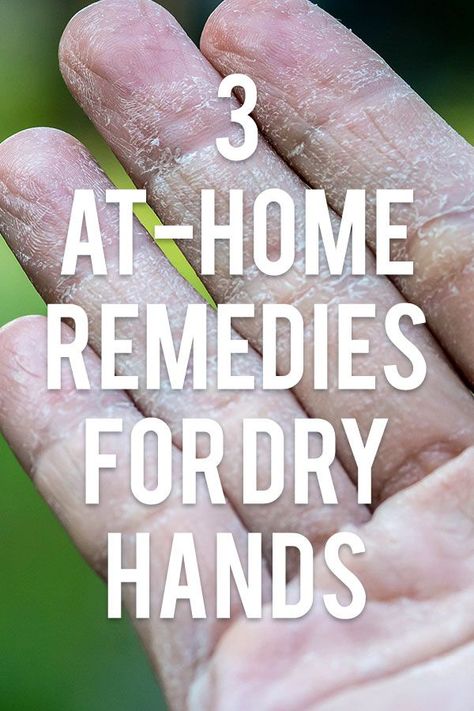 Nothing is worse than rough, dry, cracked hands. And when winter hits, like it inevitably (and unfortunately) does, it seems like there’s nothing we can do to avoid our hands from becoming this way. But before you run to the nearest drugstore to buy a quick fix, you should know that you probably already have ingredients in your own kitchen that you could use to bring your dry hands back to life! Dry Cracked Hands Remedy, Cracked Hands Remedy, Hand Remedies, Dry Hands Remedy, Extremely Dry Hands, Homemade Deodorant Recipe, Dry Hand Skin, Dry Cracked Hands, Chapped Hands