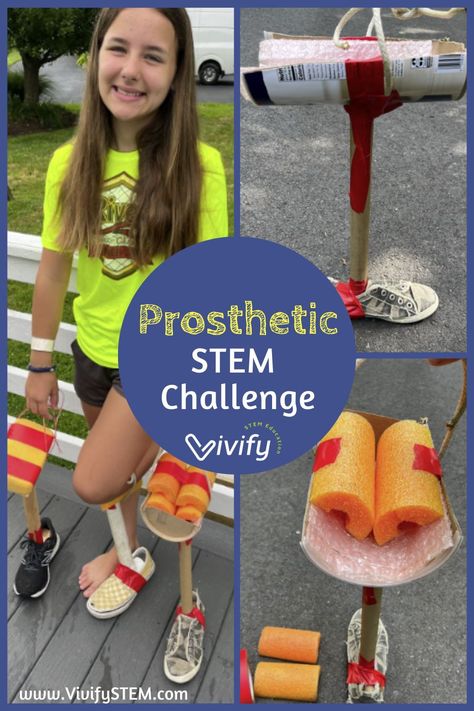 Looking for an engaging STEM activity that builds empathy? This Stage 2 STEM engineering activity challenges students to learn about and design an interchangeable prosthetic leg. Students then apply concepts for a prosthetic for their favorite animals! High School Stem Projects, Prosthetic Design, Stem Engineering Activities, Engineering Design Challenge, Elementary Science Classroom, Stem Lessons, Homeschool Stem, Elementary Stem, Stem Activities Preschool