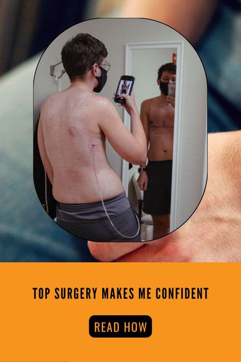 ftm top surgery, top surgery,top surgery for ftm, top surgery for trans guys, top surgery recovery, top surgery for transgender men, top surgery advices, top surgery recover, ftm top surgery advice, ftm top surgery before after, top surgery after before, Top Surgery Recovery, Top Surgery Ftm, Top Surgery, Non Binary People, Surgery Recovery, Non Binary, Surgery, To Read, Mens Sunglasses