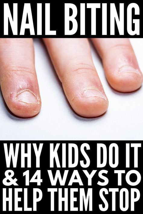 Nail Biters Tips, Tips For Nail Biters, Nail Picking Habit, How To Get Rid Of Nail Biting Habit, How To Stop Bitting Your Nails, Stop Nail Biting Diy, Nail Biting Remedies For Kids, How To Stop Picking Skin Around Nails, Ways To Stop Biting Your Nails