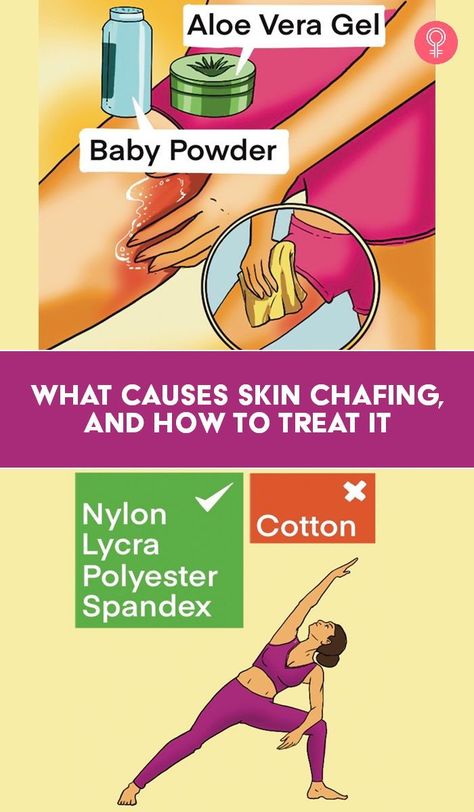 What Causes Skin Chafing, And How To Treat It: The itching and a rash may appear between the legs, on your feet, and other areas of your body. It can also happen if you work out in extremely hot or humid conditions, stroll around wearing a loose skirt, and sit in damp clothes for an extended period. This article can shed some light on the causes and remedies for chafing. Keep reading if you want to learn more about this topic. Chafing Remedies, Heat Rash Remedy, Thigh Chaffing, Rashes Remedies, Thigh Chafing, Heat Rash, Loose Skirt, Sciatic Nerve Pain, Excessive Sweating