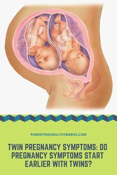 Twin Pregnancy Symptoms, Human Body Vocabulary, How To Conceive Twins, Extreme Fatigue, Baby Wrap Newborn, How To Conceive, Gestational Age, Pregnancy Info, Pregnancy Art