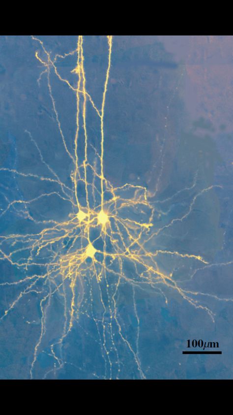 Real picture of neurons. Neurons Aesthetic, Neurons Art, Brain Project, Neuroscience Art, Brain Neurons, Systems Art, Cell Membrane, Neurology, Human Art