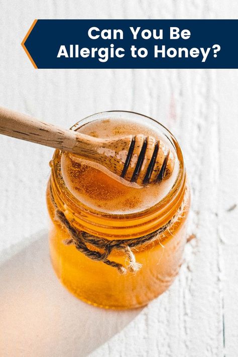 If you have bee sting allergies, have you also wondered if you could be allergic to honey? Find out the most likely causes of honey allergies. Sun Allergy, Improve Nutrition, Bee Sting, Allergy Testing, Can You Be, Raw Honey, Allergies, Honey, Bee