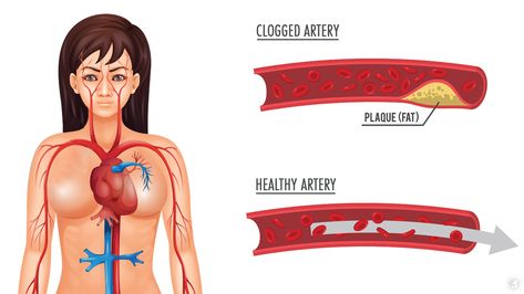 Circulation Remedies, Clear Arteries, Frankincense Oil Uses, Calendula Benefits, Zinc Deficiency, Clogged Arteries, Matcha Benefits, Coconut Health Benefits, Natural Antibiotics