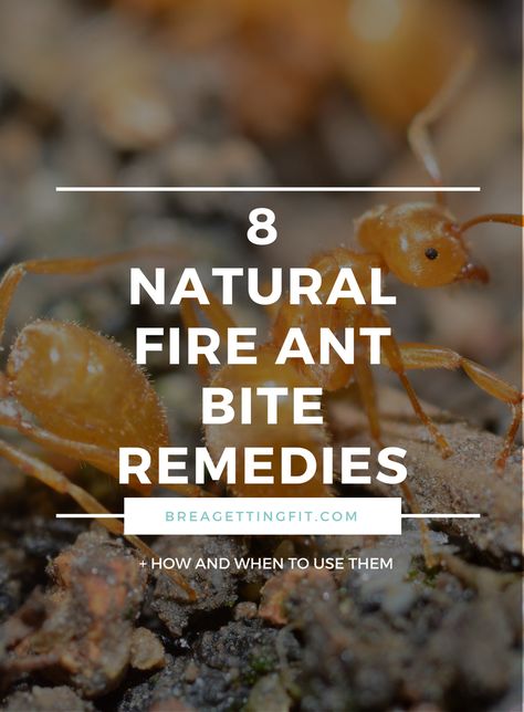 Ever been bitten by fire ants? Those suckers are VICIOUS! Find out how to help the pain and swelling using natural (and unconventional) household items. Fire Ant Bites Relief, Ant Bites Relief, Natural Remedies For Ants, Essential Oils Ants, Home Remedies For Ants, Fire Ant Bites, Bug Bites Remedies, Ant Bites, Bite Relief