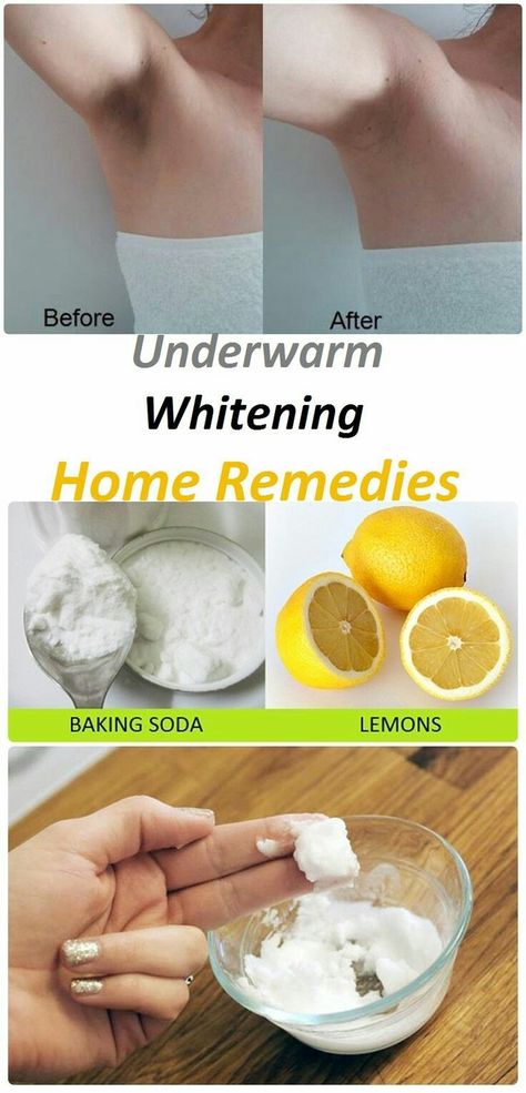 Whiten Armpits, Whiten Underarms Fast, How To Whiten Underarms, Baking Soda And Lemon, Dark Armpits, Diy Shampoo, Dark Underarms, Hair Diy, Baking Soda Shampoo