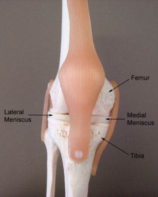 Medial Epicondyle, Medial Meniscus, Meniscus Surgery, Meniscal Tear, Surgical Technician, Human Skeleton, Medical Art, Free Education, Knee Injury