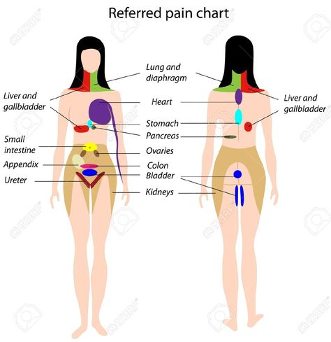 Pain Chart, Referred Pain, Middle Back Pain, Body Diagram, Lower Back Pain Exercises, Back Pain Remedies, Upper Back Pain, Back Pain Exercises, Stomach Pain