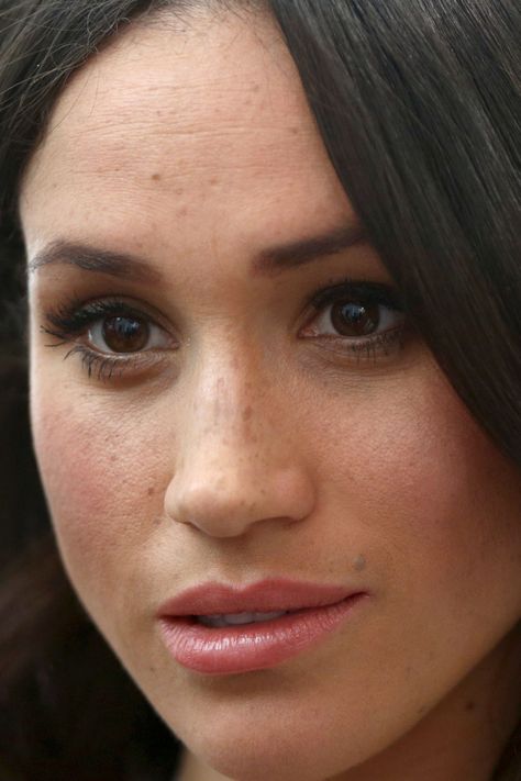 Megan Markle Nose, Meghan Markle Nose Job, Meghan Markle Hair, Meghan Markle Suits, Estilo Meghan Markle, Nose Jobs, Bad Skin, Bad Teeth, Princess Meghan