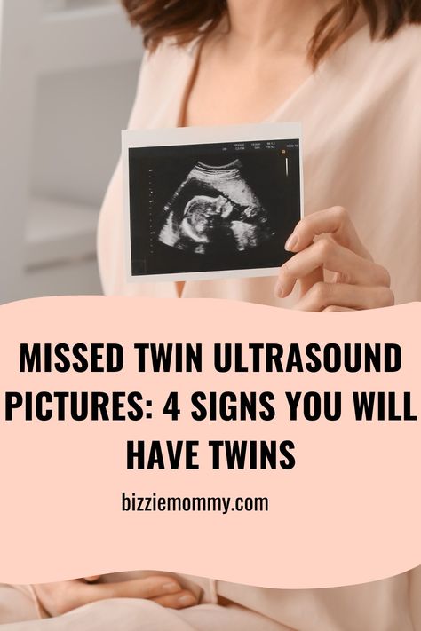 Missed Twin Ultrasound Pictures: 4 Signs You Will Have Twins Hidden Twin Ultrasound, Twin Ultrasound Pictures 8 Weeks, Twin Ultrasound Pictures, 9 Weeks Pregnant Ultrasound, Ultrasound Pictures 8 Weeks, 9 Week Ultrasound, Twin Ultrasound, 8 Week Ultrasound, Twins Ultrasound