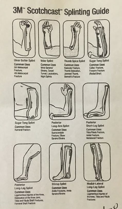 3M Splinting Guide Emergency Room Technician, Orthopedic Medical Assistant, Splinting Guide, Orthopedic Technician, Er Technician, Urgent Care Nurse, Emt Study, Orthopedic Nursing, Physical Therapy School