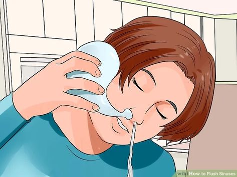 Sinus Flush, Remedy For Sinus Congestion, Home Remedies For Sinus, Sinus Congestion Relief, Sinus Allergies, Sinus Cavities, Advanced Cardiac Life Support, Neti Pot, Congestion Relief