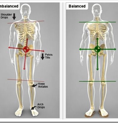 Hip Stability Exercises, Psoas Release, Runners Knee, Pie Plano, Stability Exercises, Pelvic Tilt, Chiropractic Adjustment, Tight Hip Flexors, Muscle Imbalance