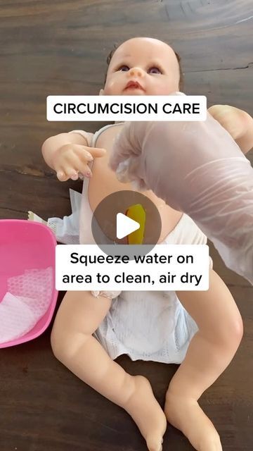 Baby Circumcision Care, Newborn Circumcision Care, Circumcision Care Newborn, Jaundice Newborn, Newborn Baby Care, Baby Information, Baby Education, Nursing Baby, Baby Tips