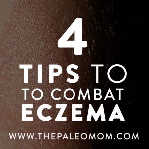 The-Paleo-Mom-4-Tips-to-Combat-Eczema Varicose Vein Removal, Teen Skincare, Skin Allergies, Skin Care Steps, Chronic Condition, Simple Skincare, Skin Conditions, Organic Skin Care, Infants