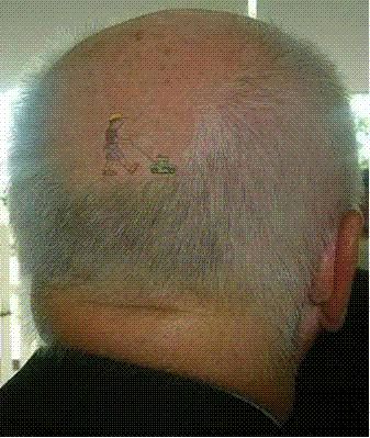 Balding head with lawn mower tattoo Lawn Mower Tattoo, Cedar Shed, Going Bald, Bald Head, Bald Heads, Gardening For Beginners, Tiny Tattoos, Lawn Care, Lawn Mower