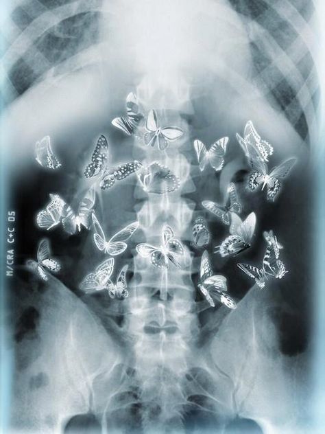 surreal Stomach Drawing, Butterflies In Stomach, Stomach Picture, فنسنت فان جوخ, Xray Art, Unique Butterfly Tattoos, Butterflies In My Stomach, Butterfly Tattoo Designs, Butterfly Drawing