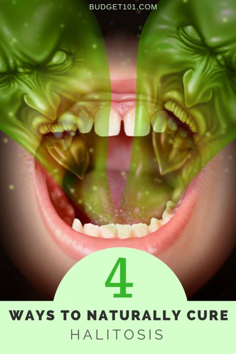 4 things that could be causing your halitosis that you didnt know about Chronic Bad Breath, Causes Of Bad Breath, Bad Breath Remedy, Small Intestine Bacterial Overgrowth, Persistent Cough, Best Probiotic, Healthy Bacteria, Stomach Pain, Tooth Decay