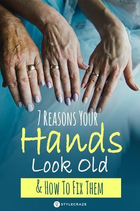 Hand Care Anti Aging, Wrinkles Hands, Natural Skin Care Remedies, Skin Care Wrinkles, Glow Skin, Skin Care Remedies, Look Older, Manicure Y Pedicure, Hand Care