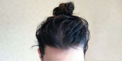 Greasy Hair, Oily Scalp, Healthy Hair Tips, Greasy Hair Hairstyles, Itchy Scalp, Sulfate Free Shampoo, Oily Hair, Diy Beauty Hacks, Beauty Makeup Tips