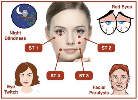 Stomach meridian points St1, St2, St3, St4 and their indications Stomach Meridian, Accupuncture Points, Facial Paralysis, Shiatsu Massage Acupressure, Meridian Points, Acupuncture Benefits, Eye Twitching, St 4, Shiatsu Massage