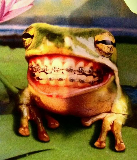 FUNNY BRACES FROG Orthodontic Humor, Braces Humor, Dental Funny, Braces Smile, Kids Braces, Cute Braces, Dental Fun, Dental Braces, Dental Art