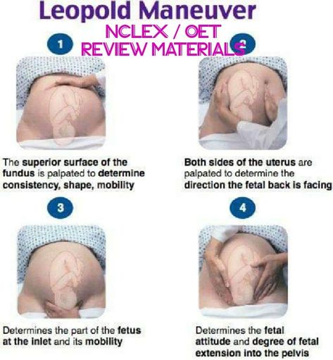 Leopold's Maneuver  @nurselinds2018   Thanks to OP!  #Leopoldsmaneuver #nursing #stydentnurse #laboranddelivery #antepartum Abscess Tooth, Obstetrics Nursing, Midwifery Student, Newborn Nursing, Dentist Teeth, Child Nursing, Student Midwife, Ob Nursing, Nurse Study Notes