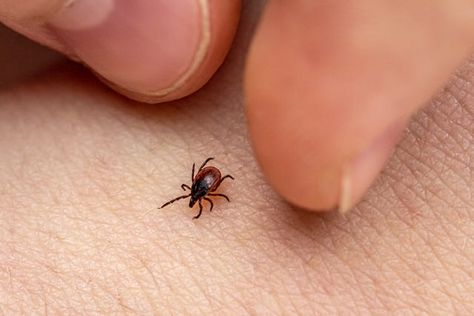 How to Remove a Tick Head Stuck in Your Skin - Tick Head Removal Steps Deer Ticks, Tick Removal, Tick Bite, Runner's World, Insect Bites, How To Protect Yourself, Flea And Tick, Itchy Skin, Ticks