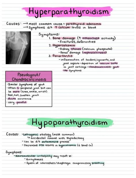 Hyperparathyroidism vs Hypoparathyroidism #medicalschool #resources #medicalstudent - Image Credits: Caroline Bontempo Preload Vs Afterload, Medical Notes, Nursing School Survival, College Advice, Nursing School Notes, Medical School Essentials, School Survival, Natural Health Tips, Nursing Notes