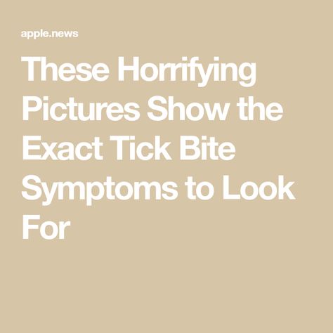 These Horrifying Pictures Show the Exact Tick Bite Symptoms to Look For Tick Bites Pictures, Tick Bite Symptoms, Tick Bite, Up Close And Personal, Ticks, Picture Show, To Look, That Look, Health