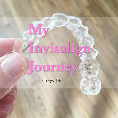 My Invisalign Journey along with Progress Photos for Trays 1-8 - curlycraftymom.com Invisalign Progress, Invisalign Tips, Shiny Teeth, Invisible Aligners, Clear Aligner, Cream Tattoo, Adult Braces, Braces Tips, Clear Braces