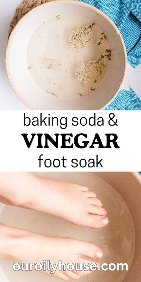 Baking Soda Foot Soak, Home Foot Soak, Natural House Cleaners, Nails Remedies, Apple Cider Vinegar Foot Soak, Vinegar Foot Soak, Diy Nail Care, Listerine Foot Soak, Diy Foot Soak