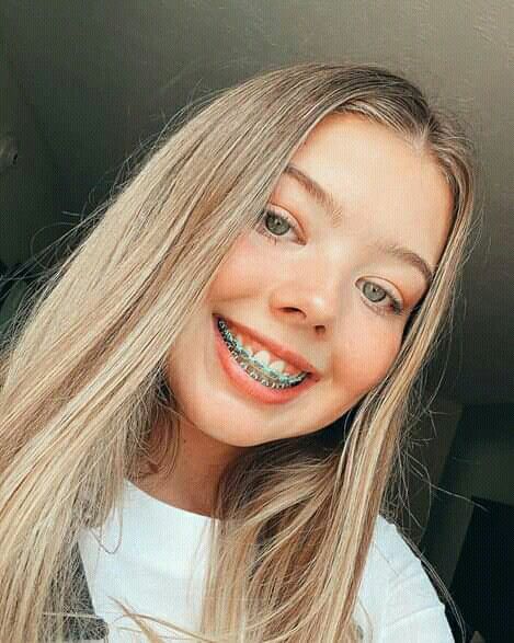 Whitney Bjerken, Orthodontic Appliances, Perfect Teeth, Friends Photo, Friend Photos, Teen Girls, Face Claims, Braces, So Excited