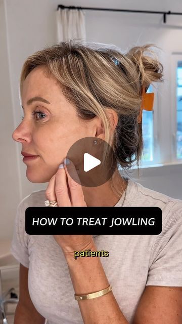 N2 Aesthetics | Medical Spa on Instagram: "The Dreaded Jowls   Preventing and treating jowls often requires a combination of treatments. Here’s a quick guide by @katieboand_pa:   Multifactorial Causes: - Volume loss - Collagen depletion - Sagging skin - Shifting fat pads - DAO and platysmal bands pulling down  Prevention is Key  Botox:Relaxes muscles that pull the jowls downward. Treating the DAO and platysmal muscle is incredibly important in prevention.   Increase Collagen and Elastin: *Softwave: Uses ultrasound waves to boost collagen and elastin production. *Microneedling  *Lasers  Filler: can add subtle volume to key areas like the preauricular area and prejowl sulcus.   #jowl  #jowling #DAO #platysmalbands #antiwrinkle #collagenproduction #dermalfiller  #katieboandpa #n2aesthetics #p How To Prevent Jowls, Jowls Makeup, Jowls Sagging, Platysmal Bands, Botox Injection Sites, Injection Sites, Best Hiking Pants For Women, Facial Injections, Collagen Injections