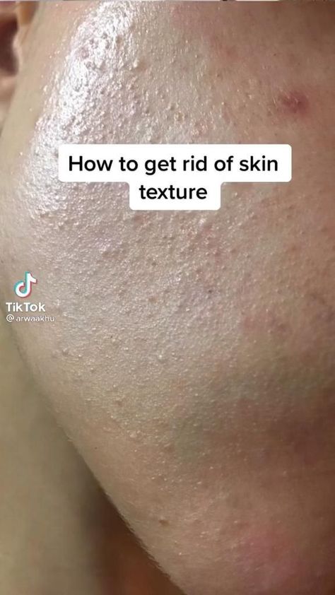 Haut Routine, Textured Skin, Bumpy Skin, Clear Skin Tips, Beauty Tips For Glowing Skin, Vegetarian Keto, Healthy Skin Tips, Facial Skin Care Routine, Skin Care Routine Steps